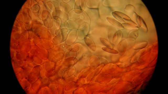 frog blood under a microscope