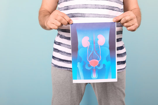 Mature man holding picture of urinary system on color background