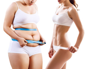 Woman's body before and after weight loss. - 207906504