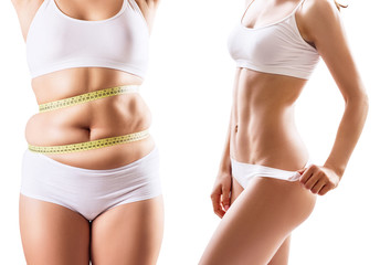 Woman's body before and after weight loss.