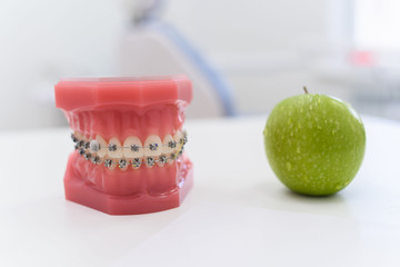 artificial jaws with braces lie with a green apple on the table