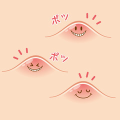 ニキビ　吹き出物