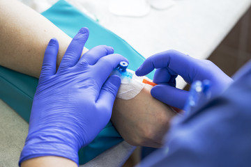 medical nurse with blue latex gloves inputs catheter to vein patient for drip of chemotherapy or another liquid medicine