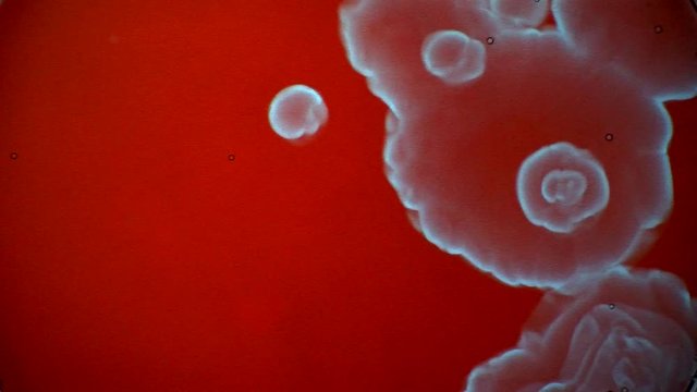 The Belousov&ndash;Zhabotinsky reaction, also known as the BZ reaction, forms concentric patterns in a chemical solution.