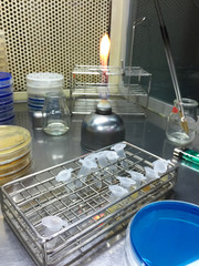 Blue agar CAS assay used for siderophore detection and white Pikovskayas (pvk) Agar for detection of phosphate-solubilizing soil microorganisms