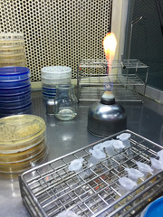 Blue agar CAS assay used for siderophore detection and white Pikovskayas (pvk) Agar for detection of phosphate-solubilizing soil microorganisms