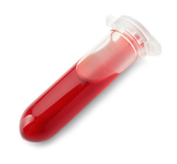 Test tube with blood samples on white background
