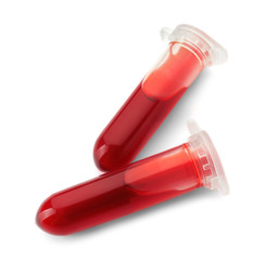 Test tubes with blood samples on white background