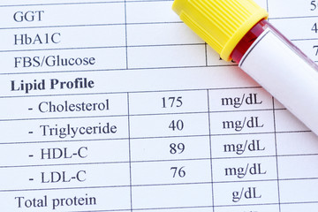 Normal lipid profile test result with blood sample tube