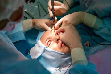 Plastic surgery in operating room
