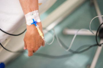 Peripheral venous catheter on the hand of young woman