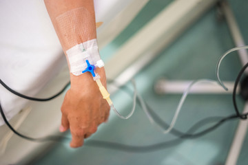 Peripheral venous catheter on the hand of young woman