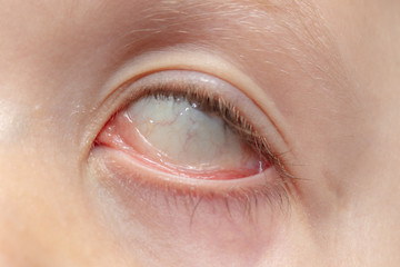 Fototapeta premium The boy's eyes are like a background