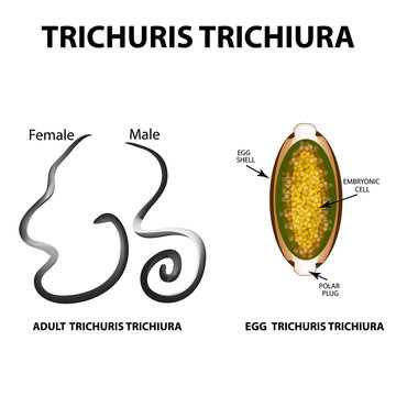 Trichuris trichiura structure of an adult. The structure of the egg Trichuris trichiura. Set. Infographics. Vector illustration on isolated background.