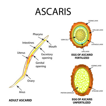 Ascaris the structure of an adult. Fertilized and unfertilized egg. The structure of the egg ascarids. Set. Infographics. Vector illustration on isolated background.