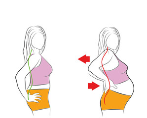 Pregnant woman. Backache. Vector illustration.