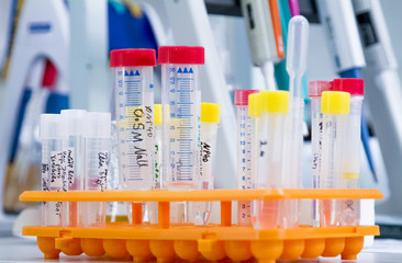 A set of test tubes with reagents in a tripod. Preparation for the experiment. A tripod with test...
