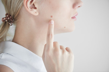 The mole on the girl's face closeup