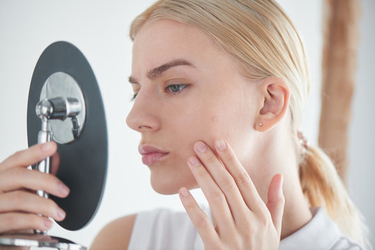 Skin Problems. Girl Looking In The Mirror