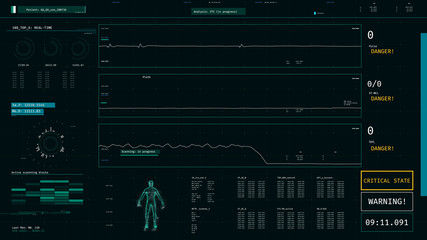 ICU monitor with warning message, patient dying, vital signs dropping on screen. 3D illustration
