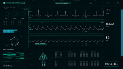 ICU monitor showing patient's condition, health, vital signs. Modern design. 3D illustration