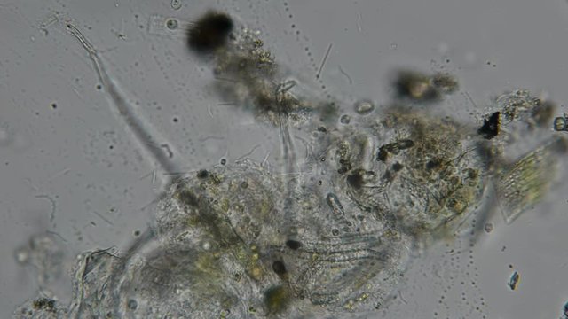 a dirty drop of water with a rod-shaped bacterium and spirochaete under a microscope