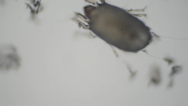 顕微鏡で見たハウスダストに潜むダニ