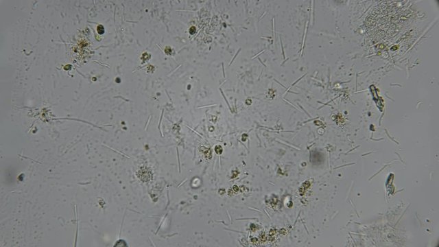 a dirty drop of water with a rod-shaped bacterium and spirochaete under a microscope