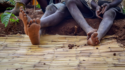 Poor young villager barefoot in Malawi, Africa - obrazy, fototapety, plakaty