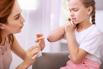 Loving mother. Nice pleasant woman looking at her daughters bruise while applying ointment on it - obrazy, fototapety, plakaty