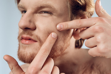 Obraz premium Close up. Red haired young man squeeze out pimple
