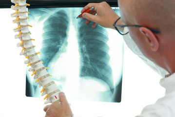specialist  with model of sine in hand,watching image of chest at x-ray film viewer