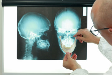 Professional with model of lower jaw watching images of skull  at x-ray film viewer. Diagnosis,treatment planning