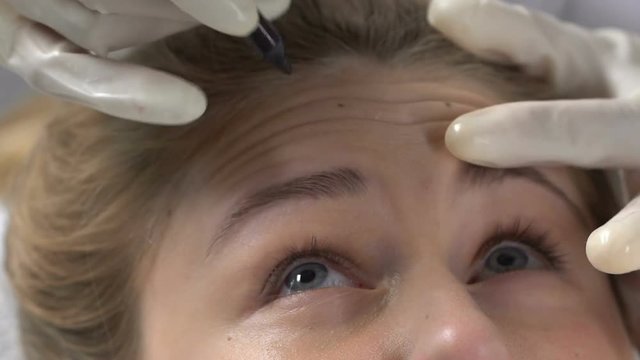 Cosmetologist marking forehead wrinkles before filler injection, skin perfection