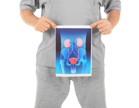Mature man holding picture of urinary system on white background