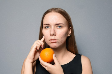 Young woman with acne problem holding orange on color background. Skin allergy