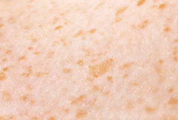 Texture of skin, closeup