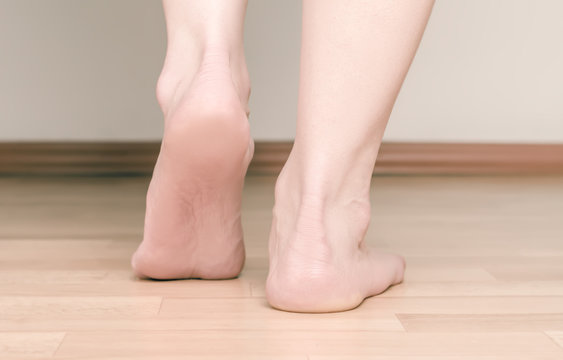 Heel and foot girl. The concept of flat feet.