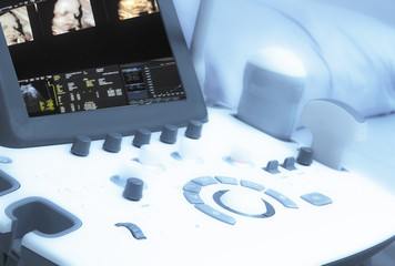 Drak and Blurry Medical ultrasound machine with 3D/4D image and linear probes in a hospital...