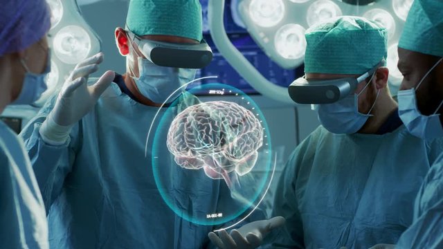 Surgeons Wearing Augmented Reality Glasses Perform Brain Surgery with Help of Animated 3D Brain Model, Using Gestures. Animation Shows Tumor. Futuristic Hospital.