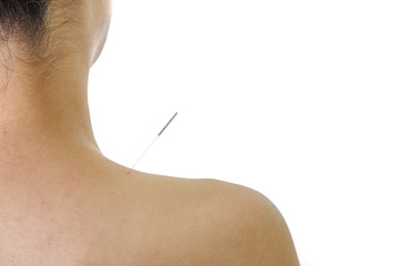 鍼治療 イメージ