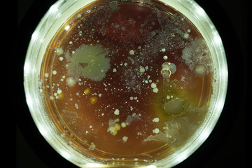 Growing Bacterial Colonies In Petri Dish