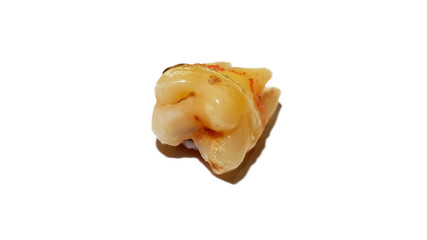 close-up tooth decay isolated on white background