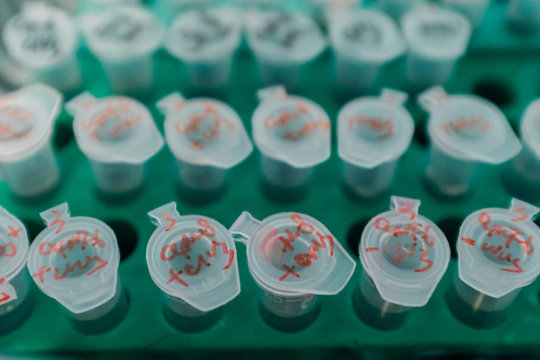 plant cells genetic science research in a lab