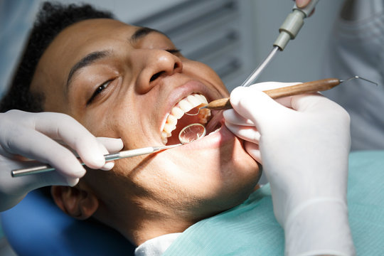 Dentist examining oral cavity of young African-American man working in in dental clinic with assistant. 