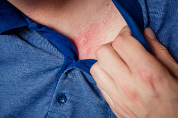 a bite of a man in a blue shirt