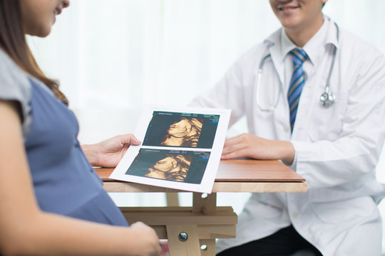Woman doctor to show the echo photo to pregnant women