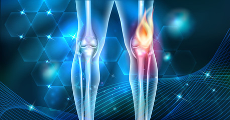 Knee pain abstract joint burning design