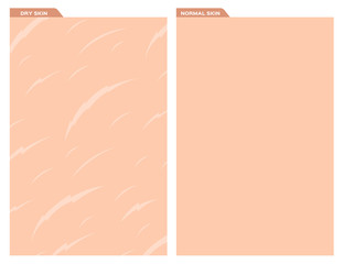 Dry skin, Nice skin texture , vector