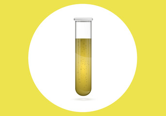 Urine test for doping in a glass tube. Medical examination.